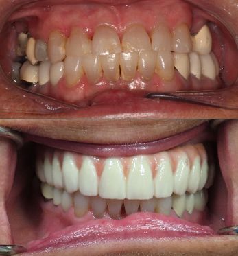 before and after dental in tucson az
