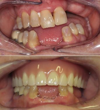 before and after dental in tucson az