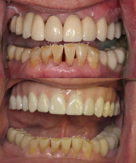 before and after dental in tucson az