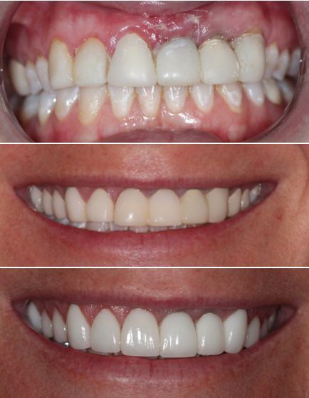 before and after dental in tucson az