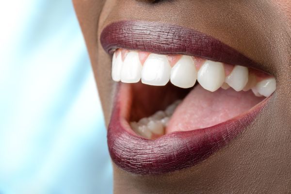 A Full Mouth Reconstruction Can Help Fix Your Smile
