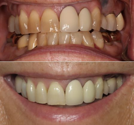before and after dental in tucson az