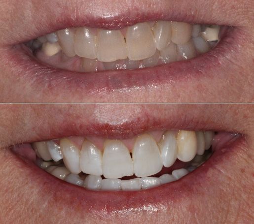 before and after dental in tucson az