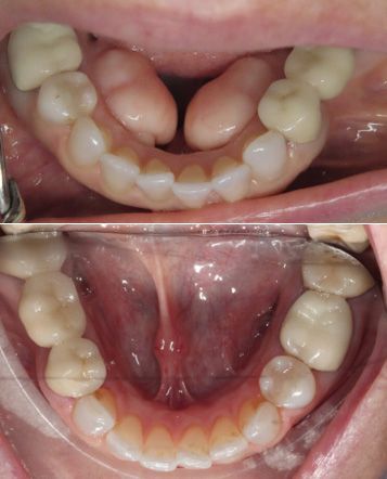 before and after dental in tucson az