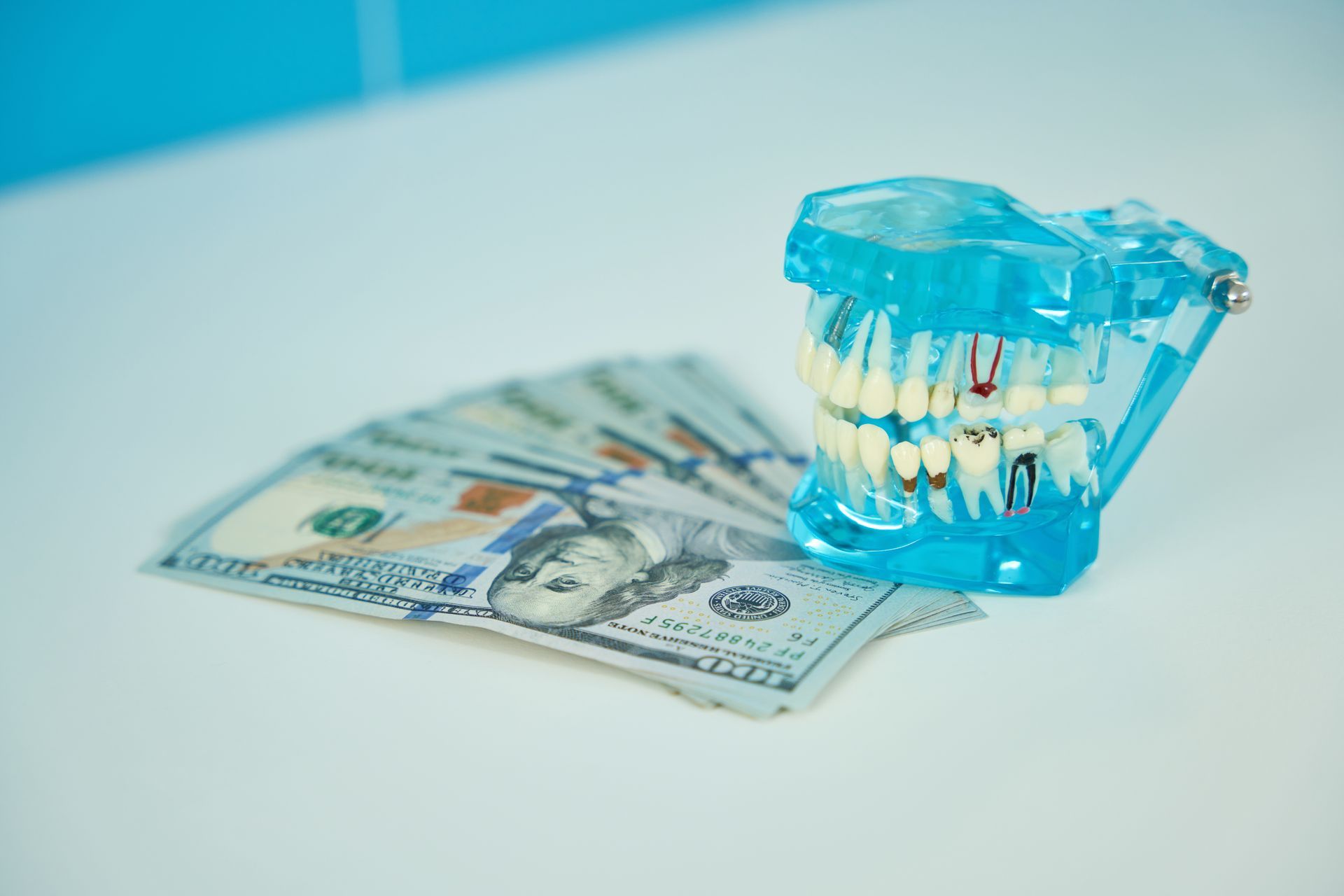 Model of teeth next to a stack of US $100 bills, symbolizing dental care costs.