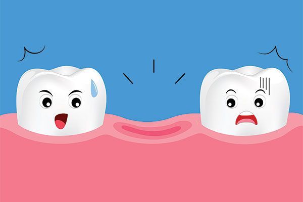 Going to an Emergency Dentistry Clinic During COVID-19 for a Knocked-Out Tooth
