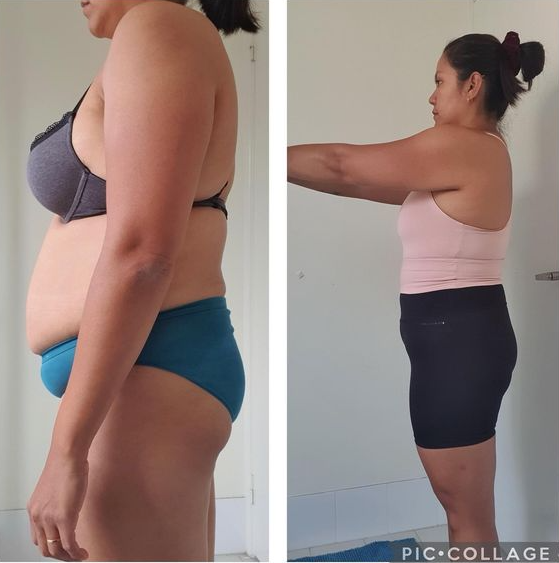 Client before and after picture