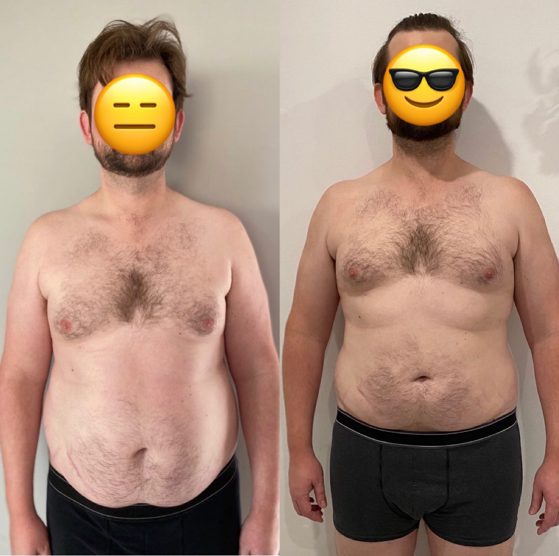 Client before and after picture