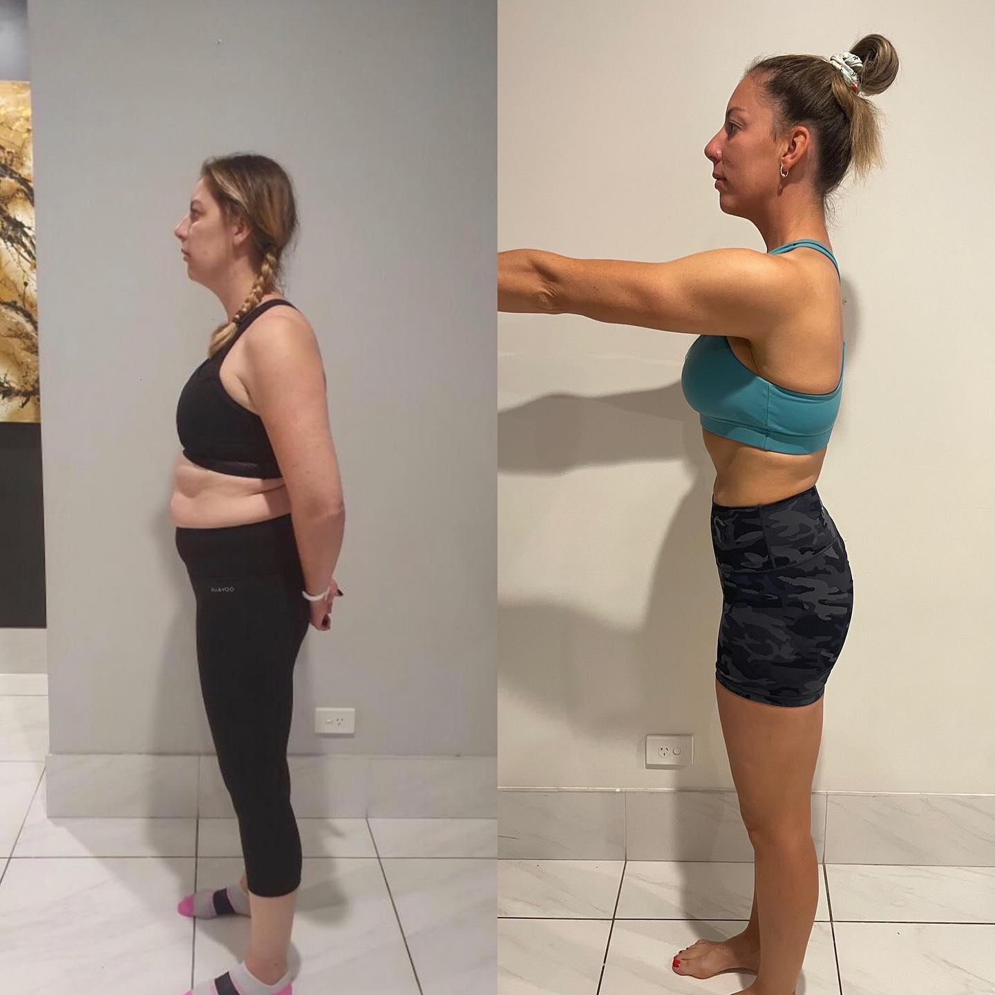 Client before and after picture