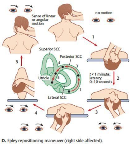 Conheca As Causas De Vertigem E Saiba Como Tratar