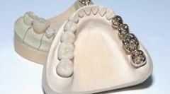protesi, apparecchi ortodontici