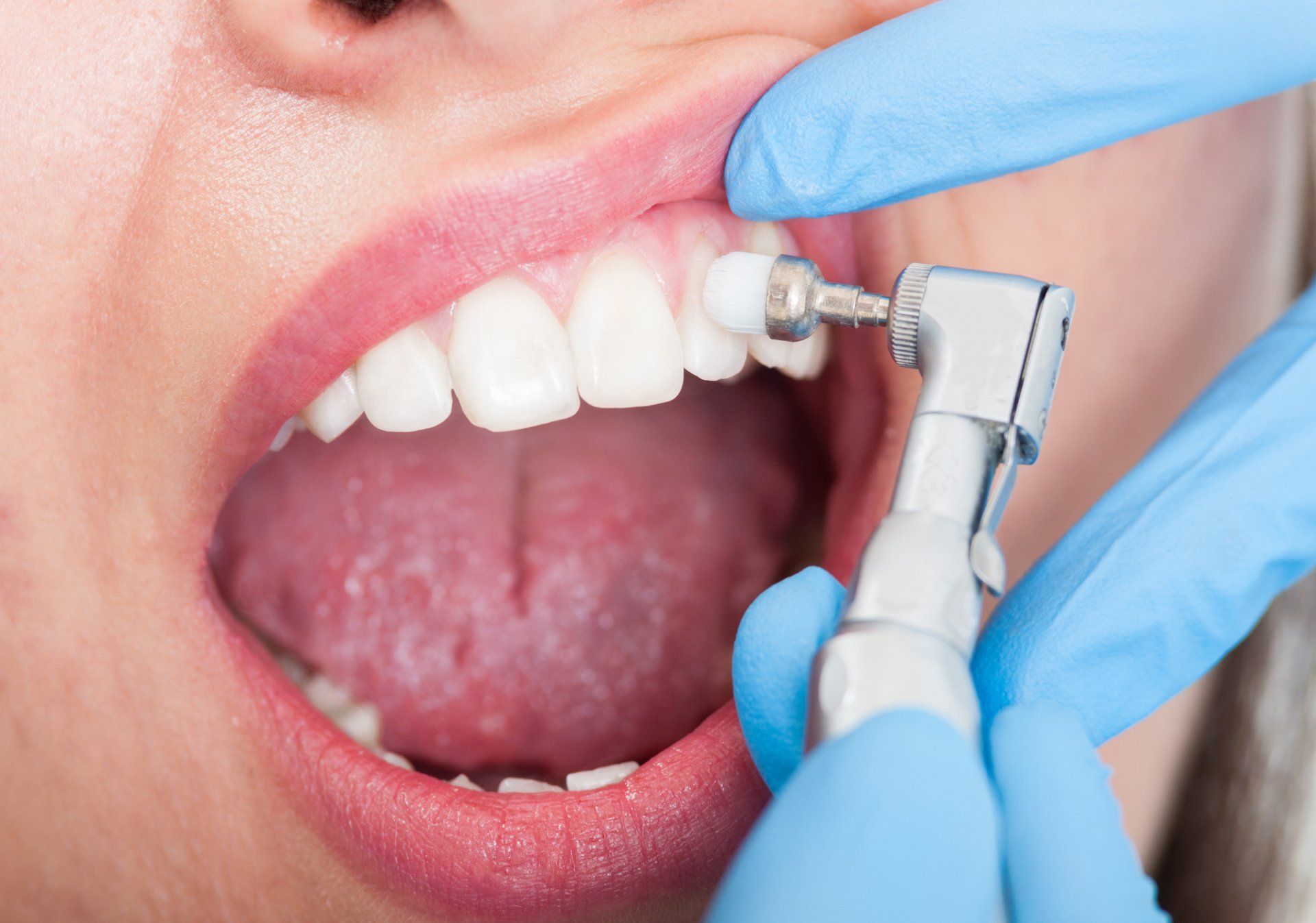 A woman is getting her teeth cleaned by a dentist