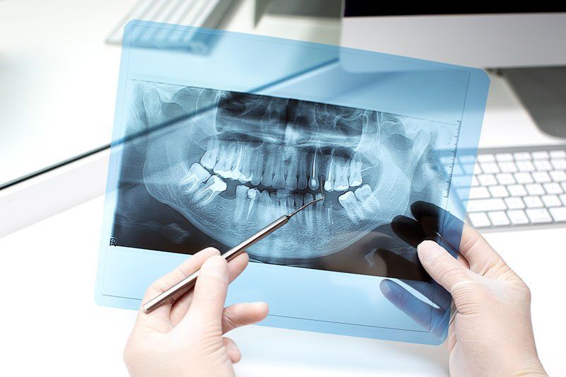 Dantų rentgenograma