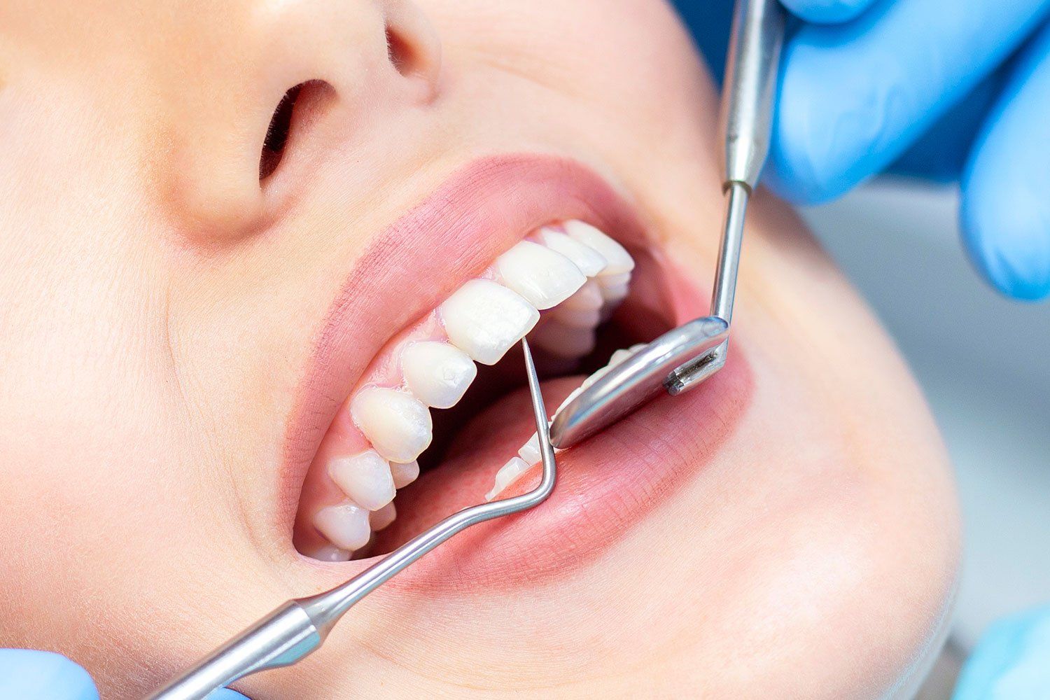 Profilaktinė dantų apžiūra ir gydymas