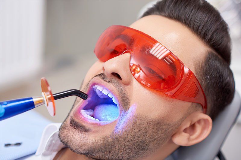 Dantų plombavimas, gydymas
