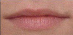 Permanent lip makeup before — Oklahoma City, OK — Permanent Makeup by Kim Warren