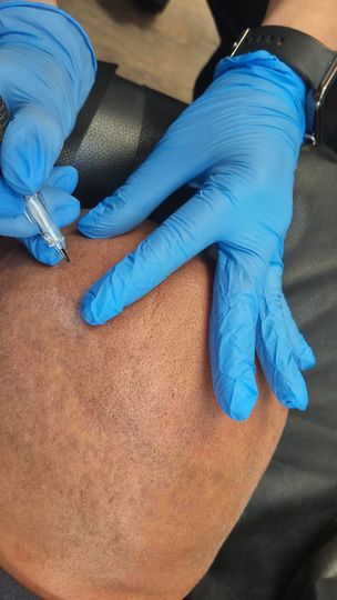 Primo piano di una testa dalla pelle scura con l'attaccatura dei capelli modellata con uno strumento di precisione.