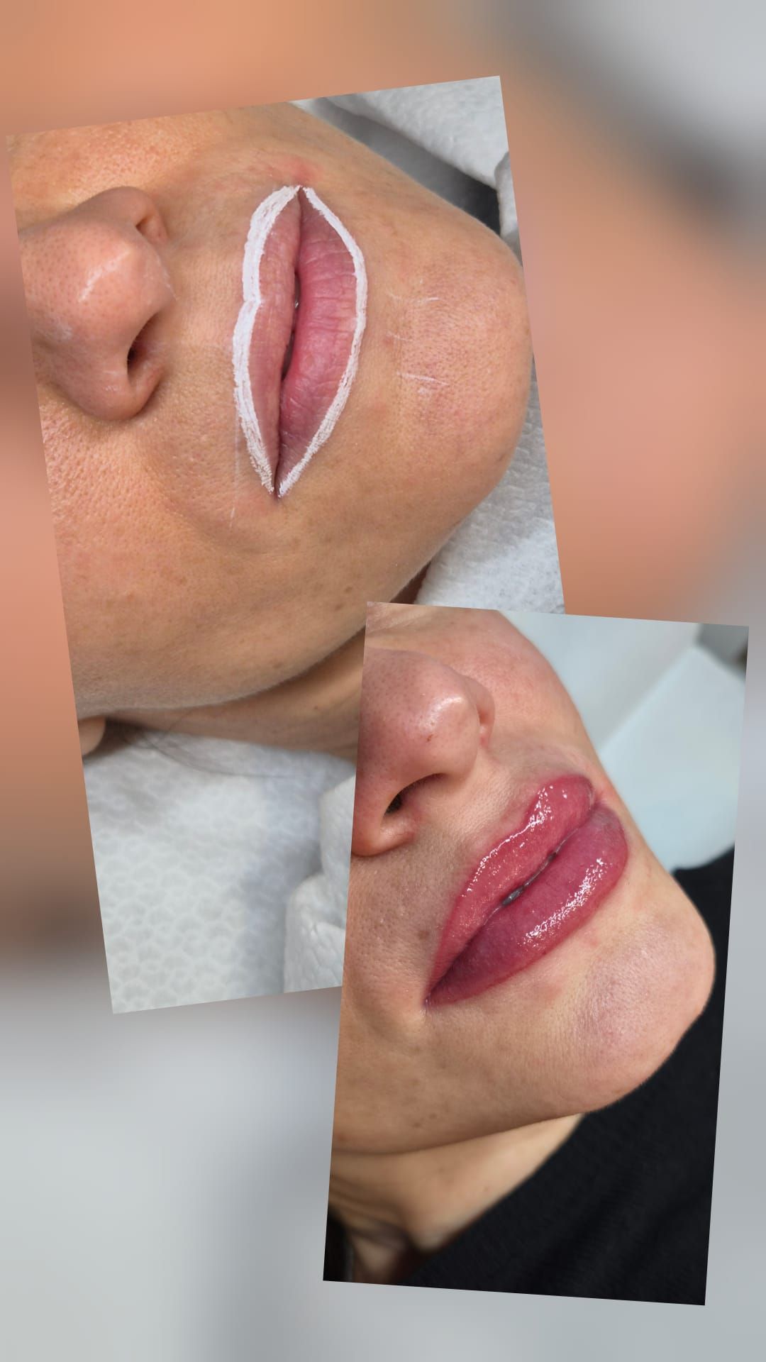 Primo piano della bocca di una persona con un rossetto lucido color malva; sono visibili i denti.