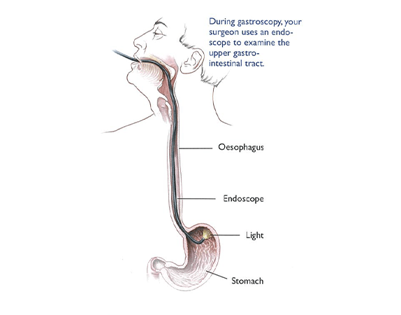 Colonscopy procedure 2