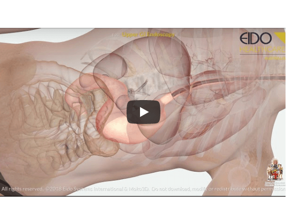 Gastrocopy video screenshot
