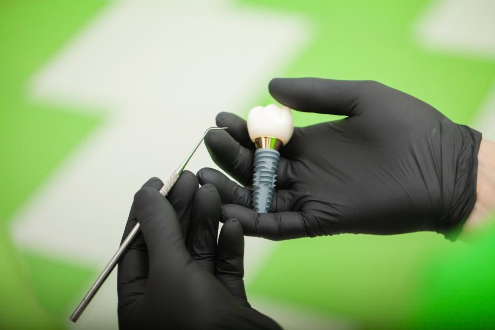 A person wearing black gloves is holding a dental implant in their hand.