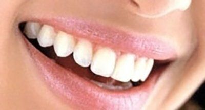 primo piano di denti bianchi