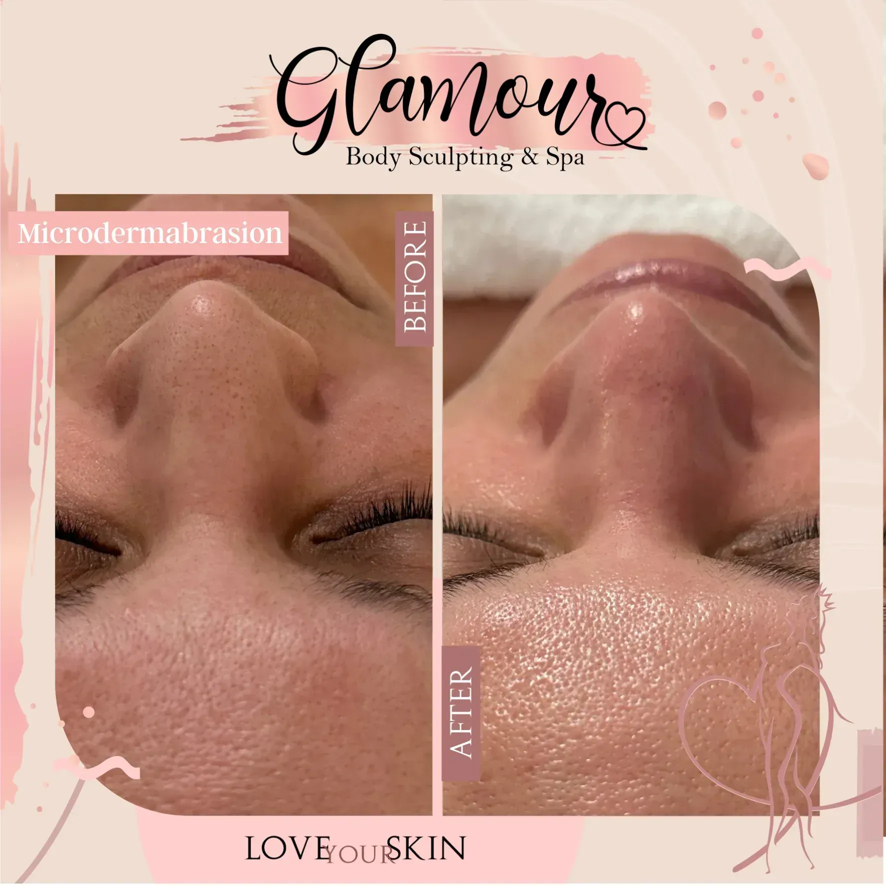 Comparison of skin texture 