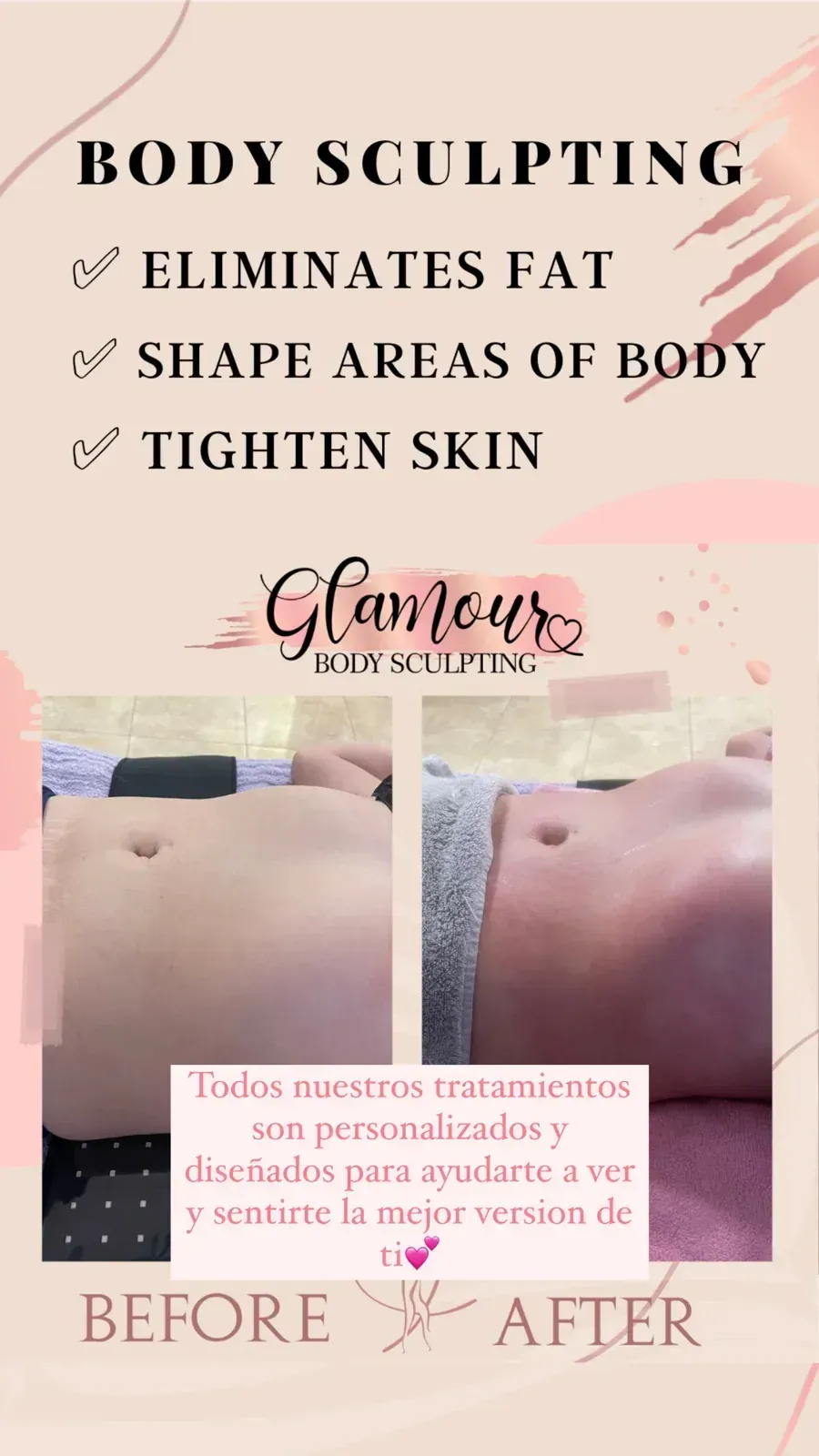 Body sculpting advertisement: before and after shots, text about fat elimination, body shaping, and skin tightening.