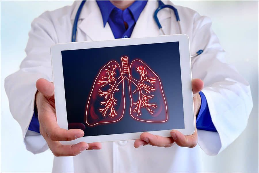 Broncoscopia con tomas de biopsia