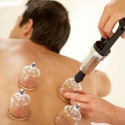 Add Ons: Cupping Therapy