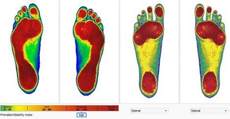 Link to how foot pain is treated at Salina KS Living Well Chiropractic Clinic