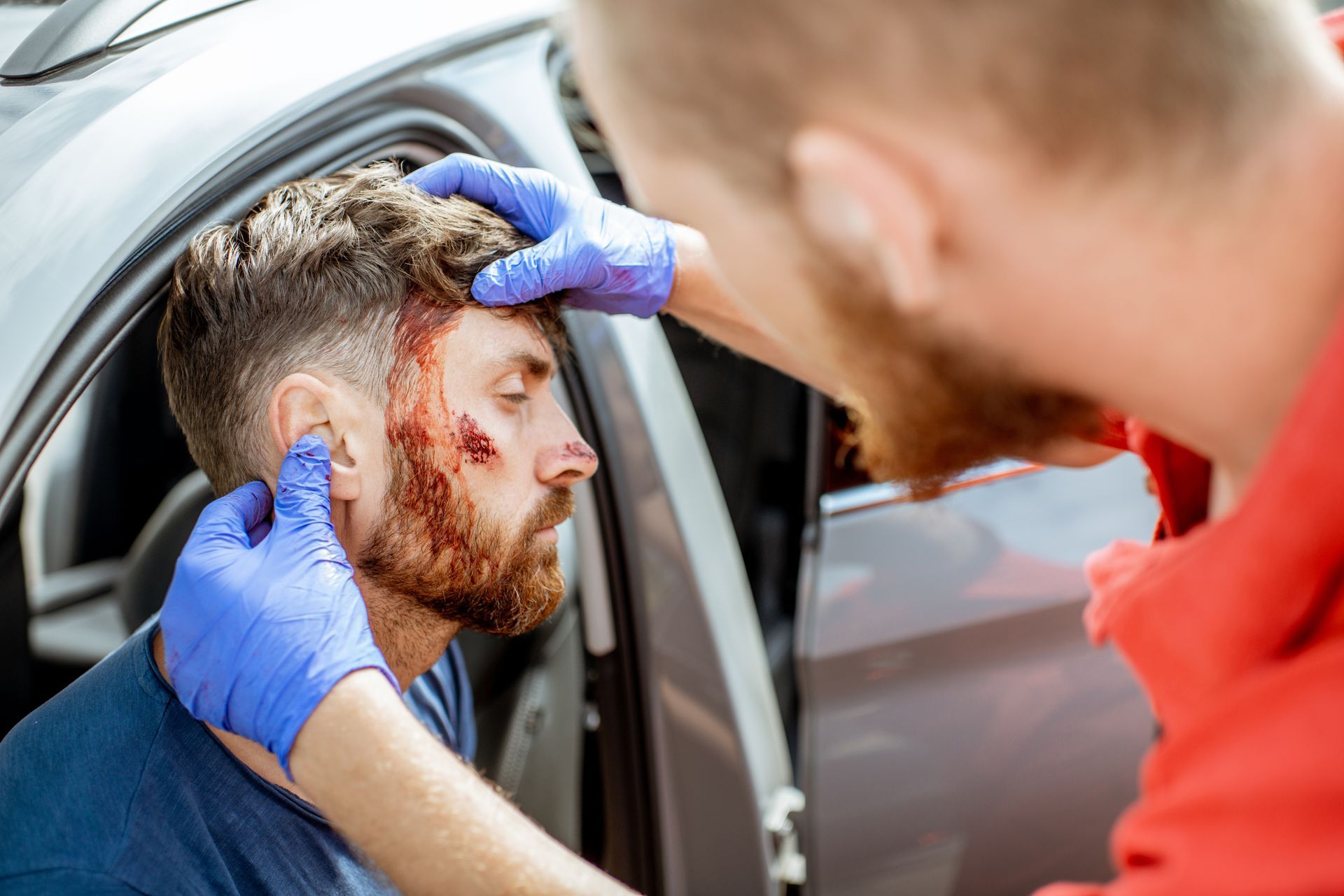 Facial scarring after a crash