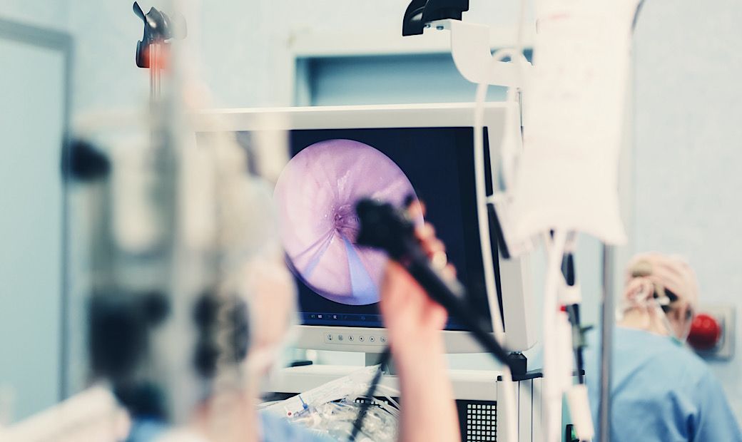 doctors in operating room performing colonoscopy with medical imaging