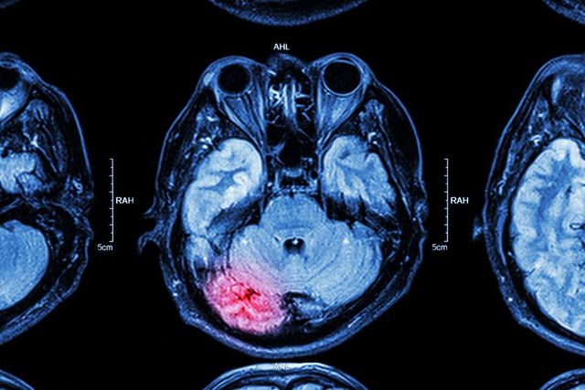 Mri Minor Injuries Unit