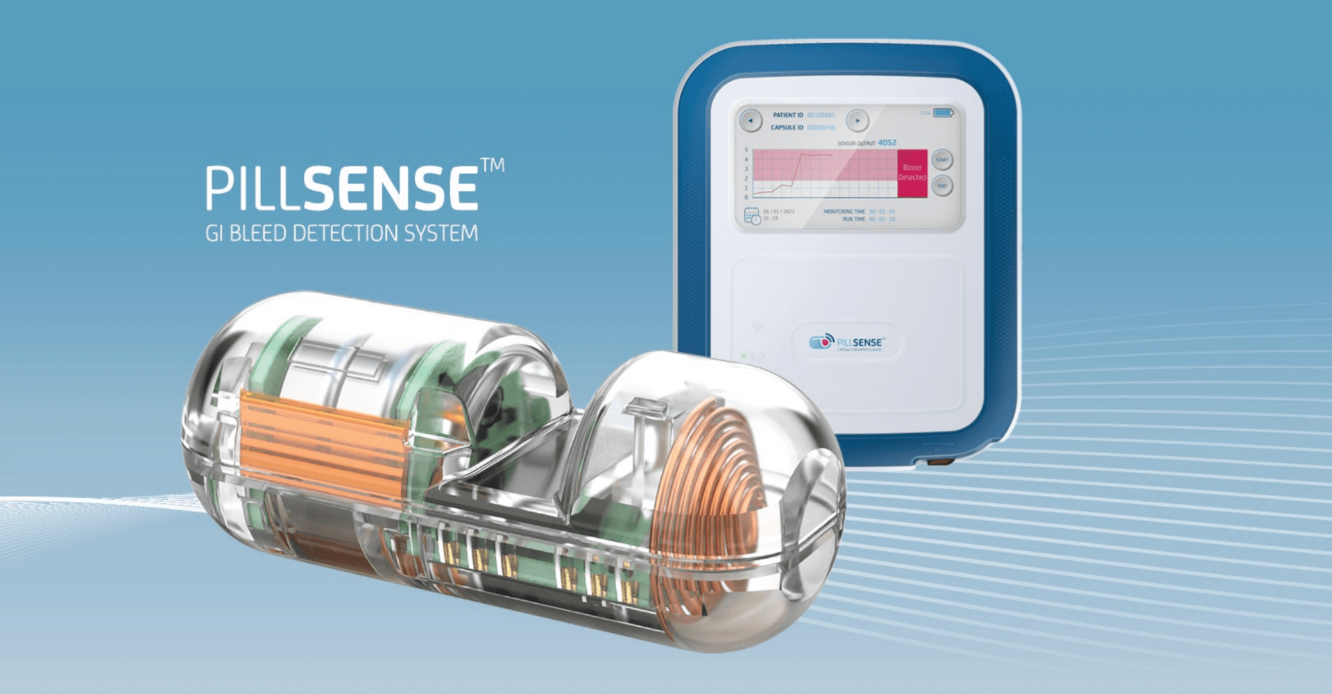 PillSense ingestible capsule and external receiver for upper GI bleed detection using light absorpti