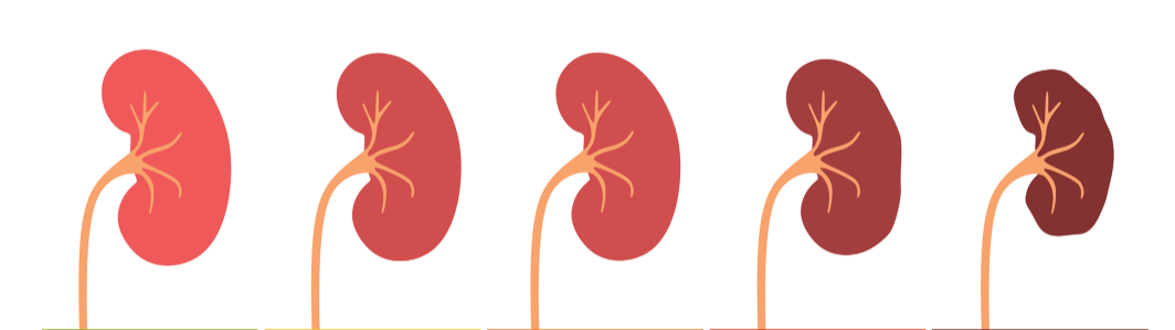 A row of red kidneys on a white background.