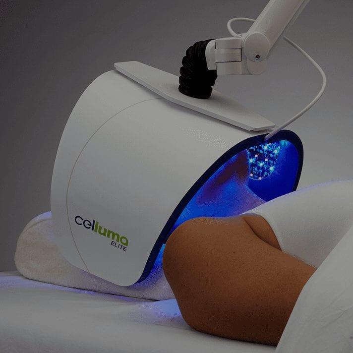 A person is laying on a bed with a celluma light therapy device at Results Skincare Studio in Fort Myers