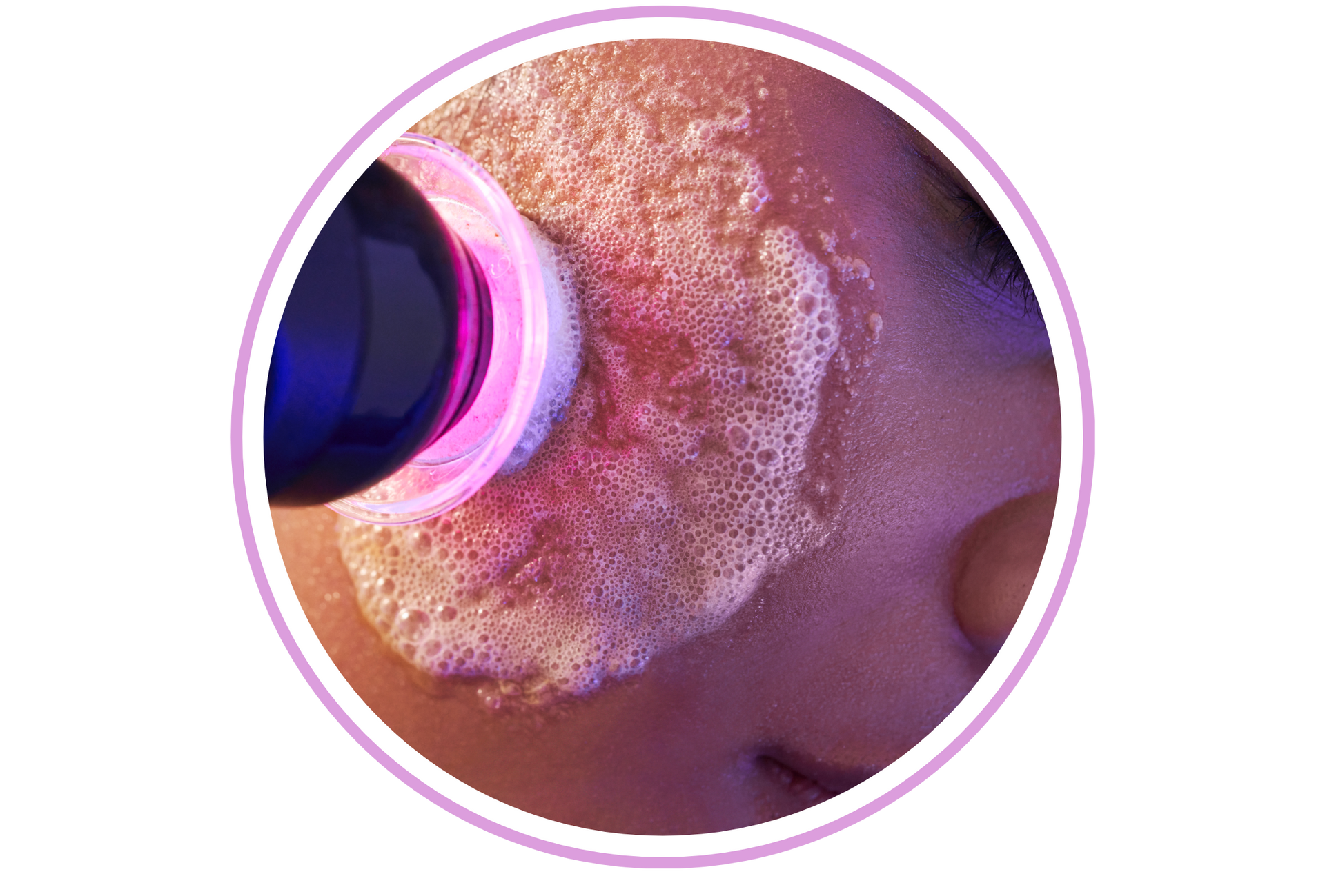 Person's face being treated with pink and purple light from a skincare device.