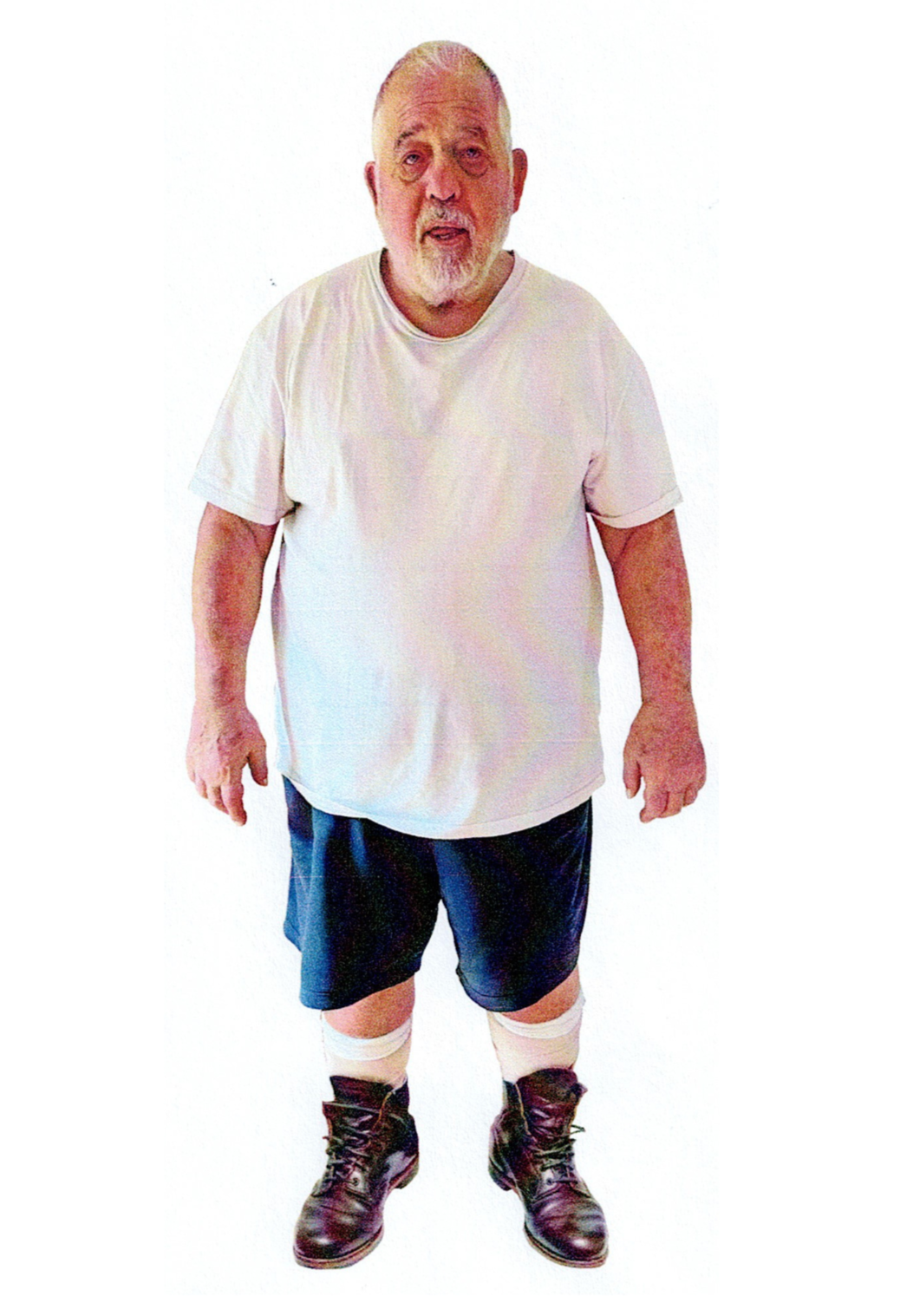 Frau in weissen Shorts und gepunktetem Oberteil lächelt.