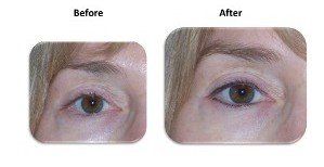 eyebrows before and after