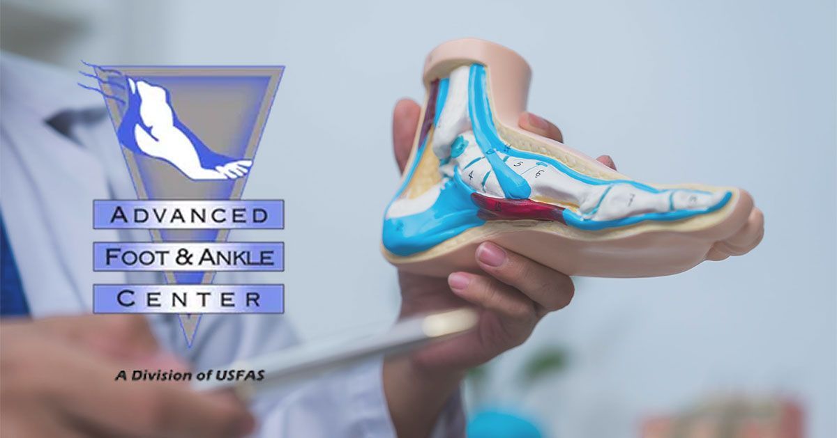 Corns Treatment | Advanced Foot & Ankle Center