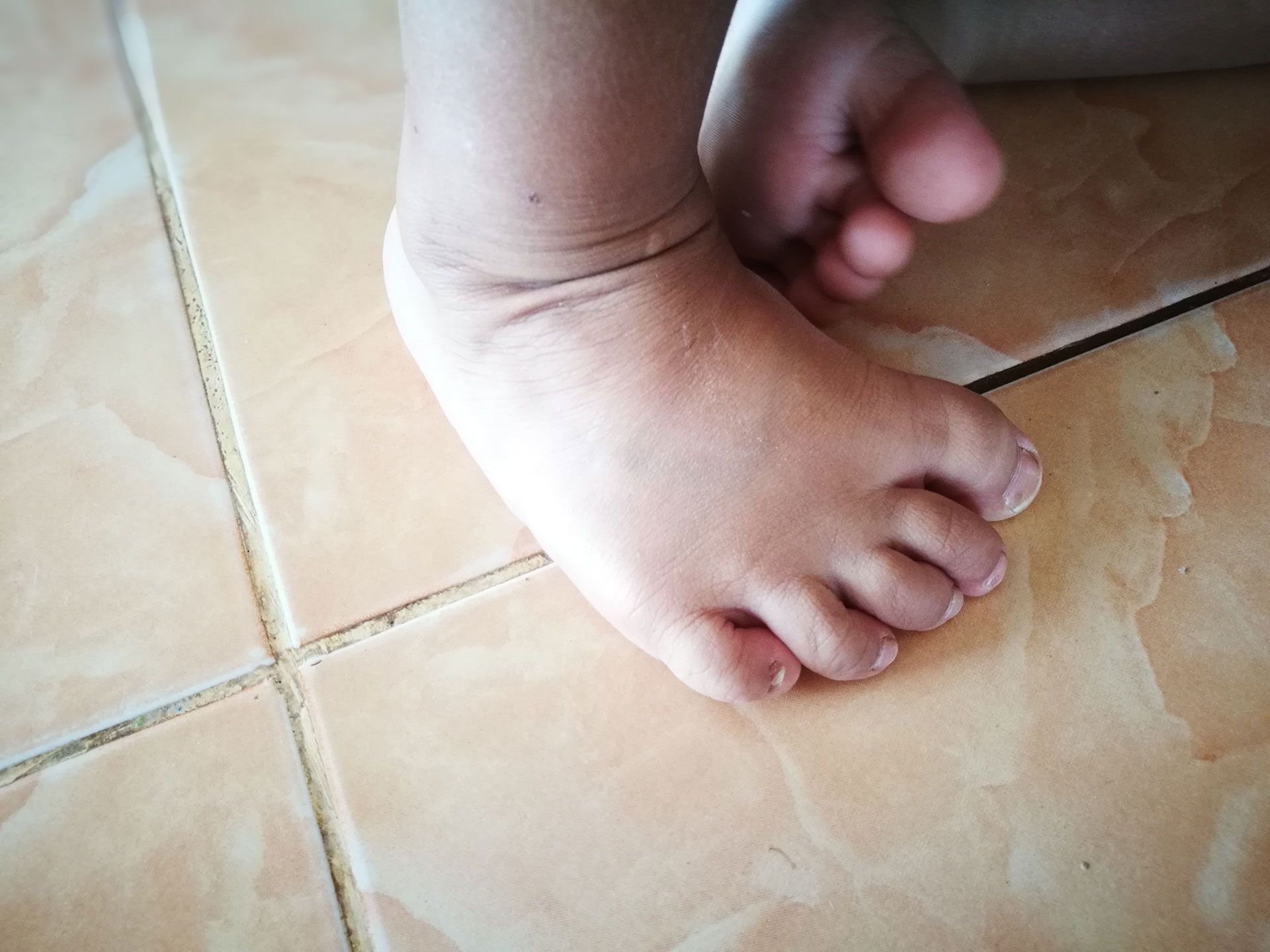 A person is getting a foot massage on a table.