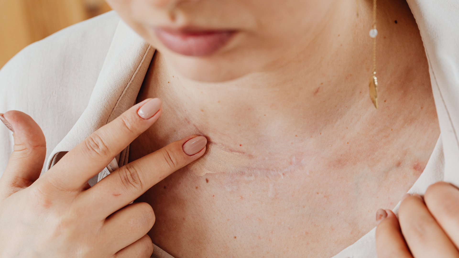 Woman pointing to a scar on her chest, wearing a white shirt and jewelry.
