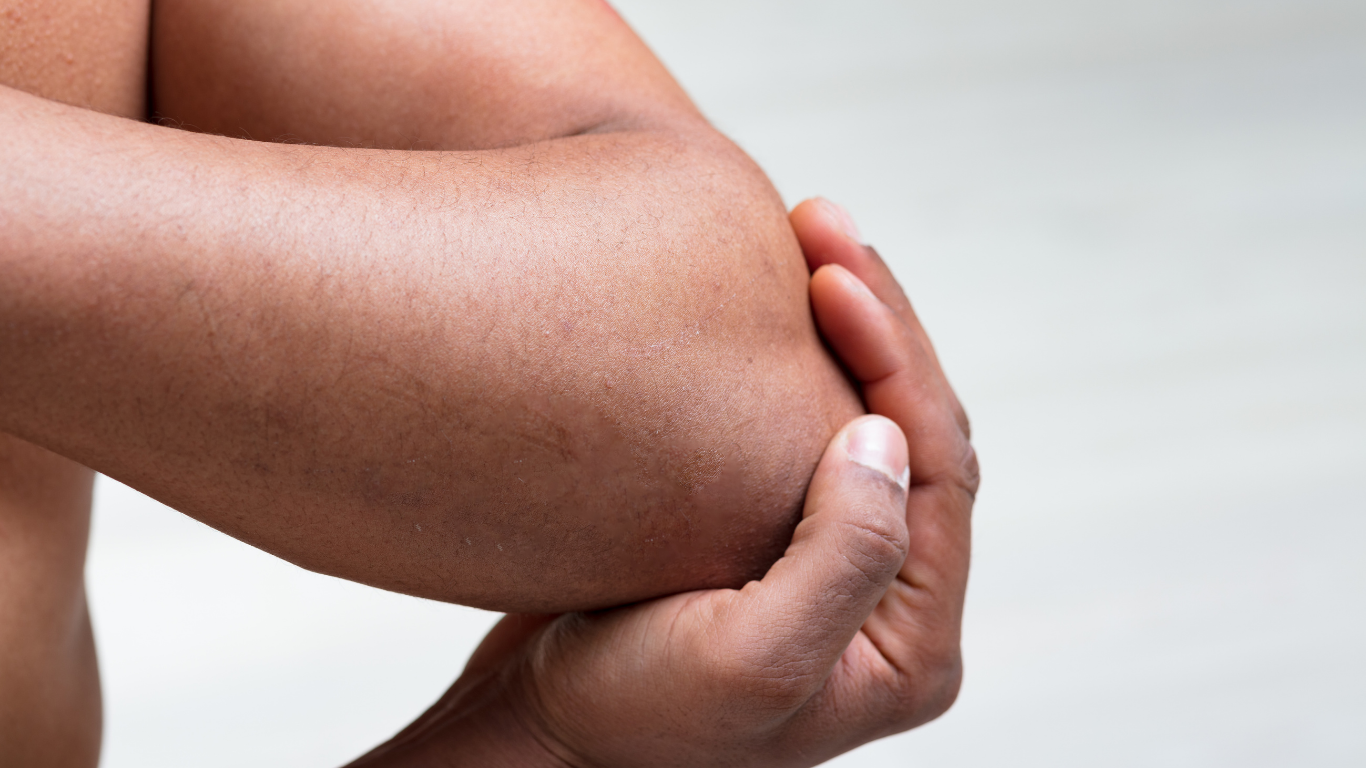 Person holding their elbow, appearing to be in pain. The arm is dark-skinned against a light background.