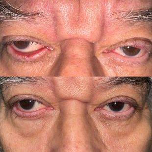 Cirugía reconstructiva ocular
