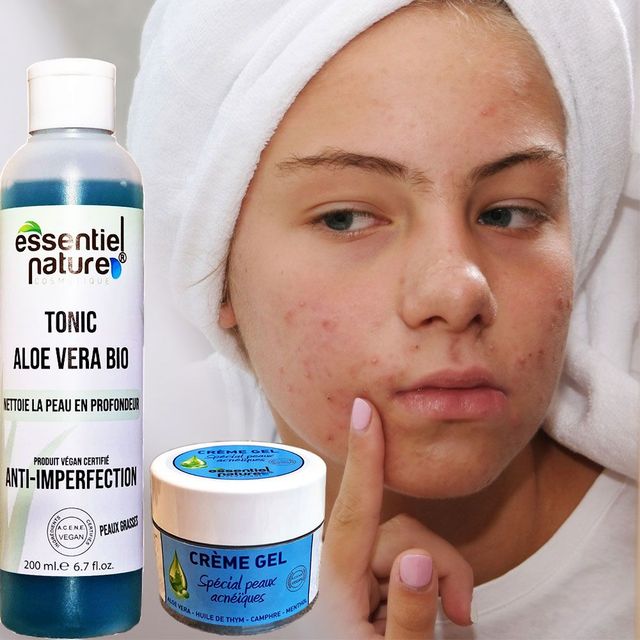 SOIN SPCIAL DES PEAUX GRASSES ALOE VERA
