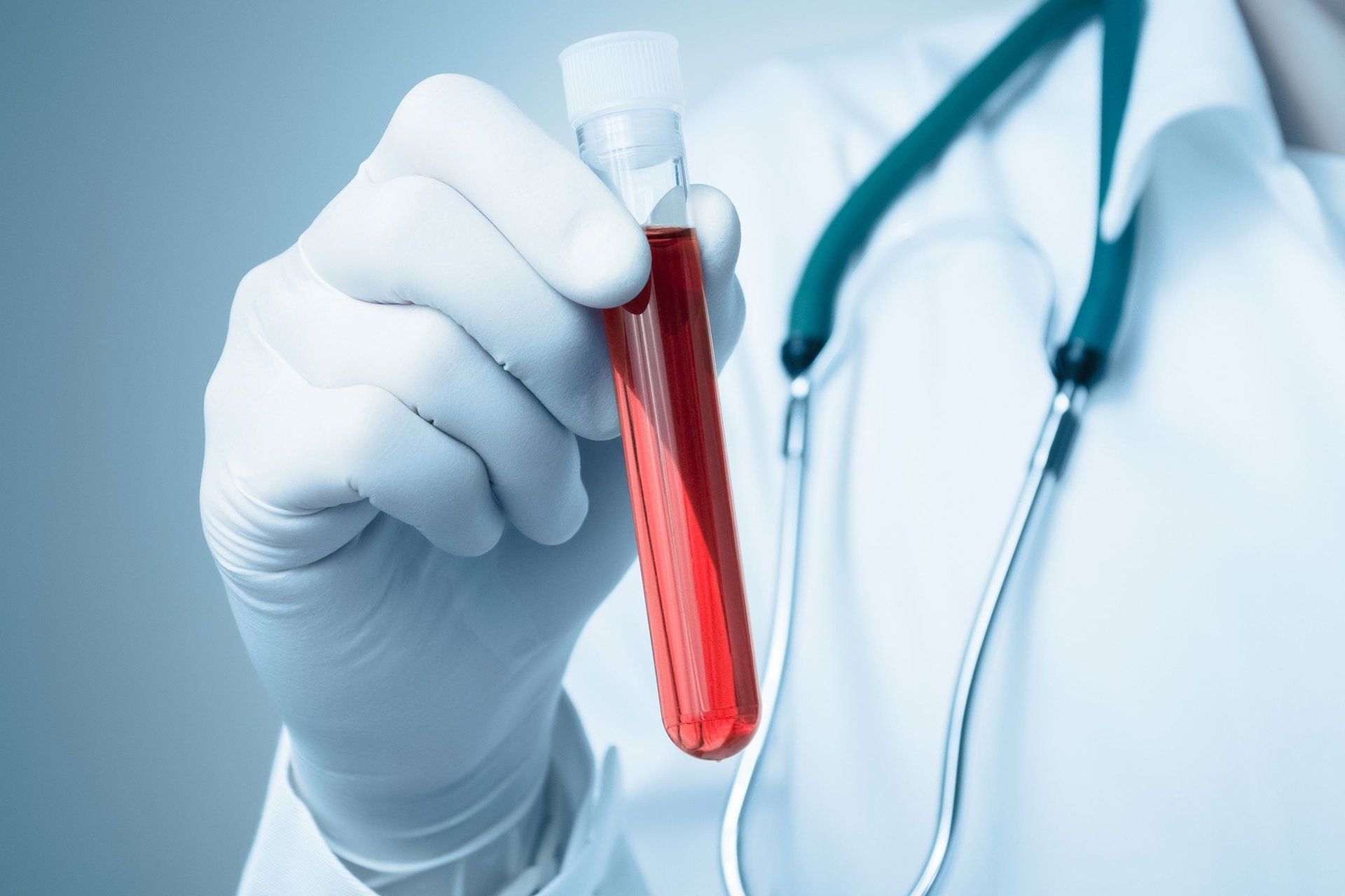 Mano con guanto e provetta di sangue