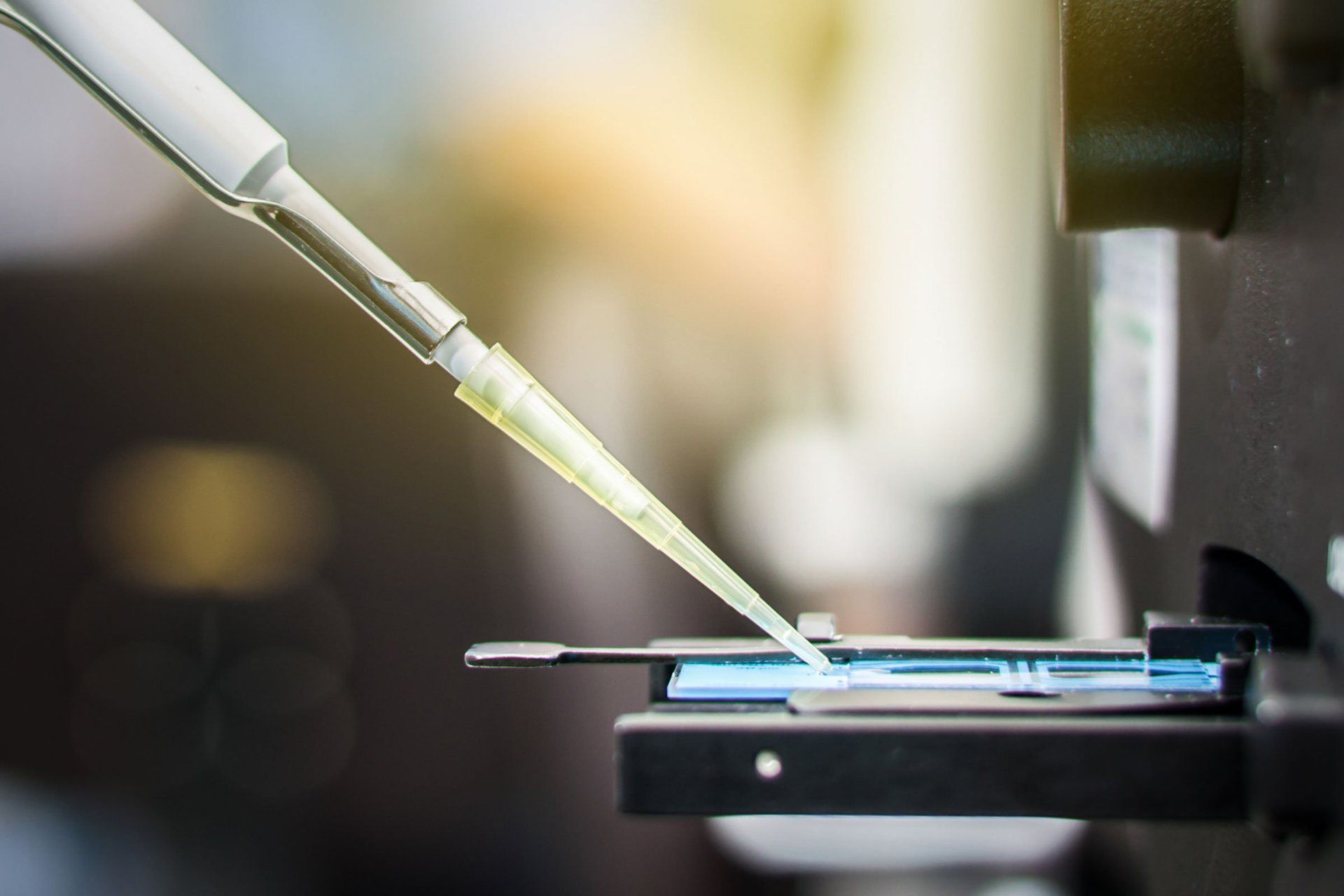 Provetta preleva campione per esame alla tiroide