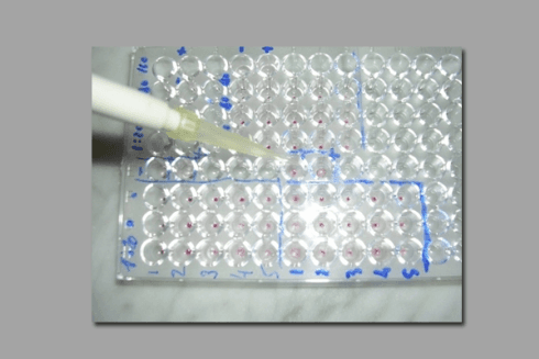 Provette prelievi di sangue