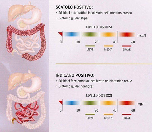 test disbiosi intestinale